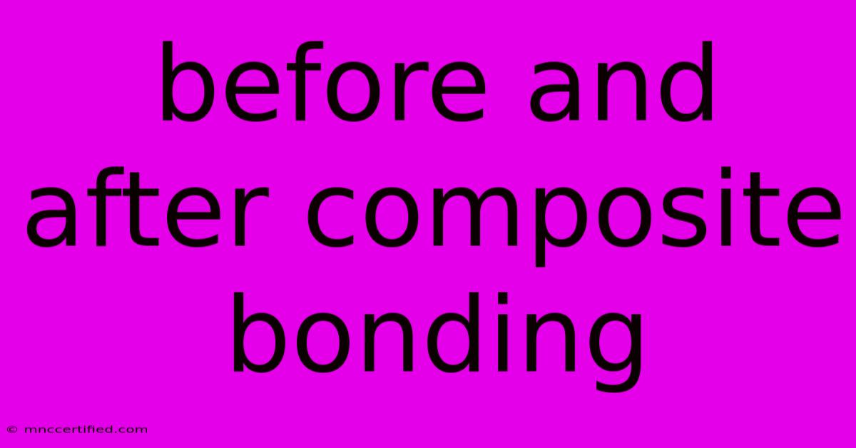 Before And After Composite Bonding