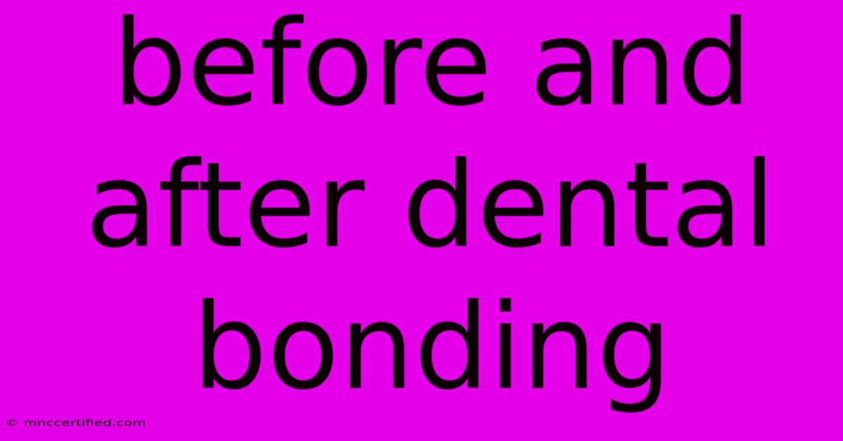 Before And After Dental Bonding