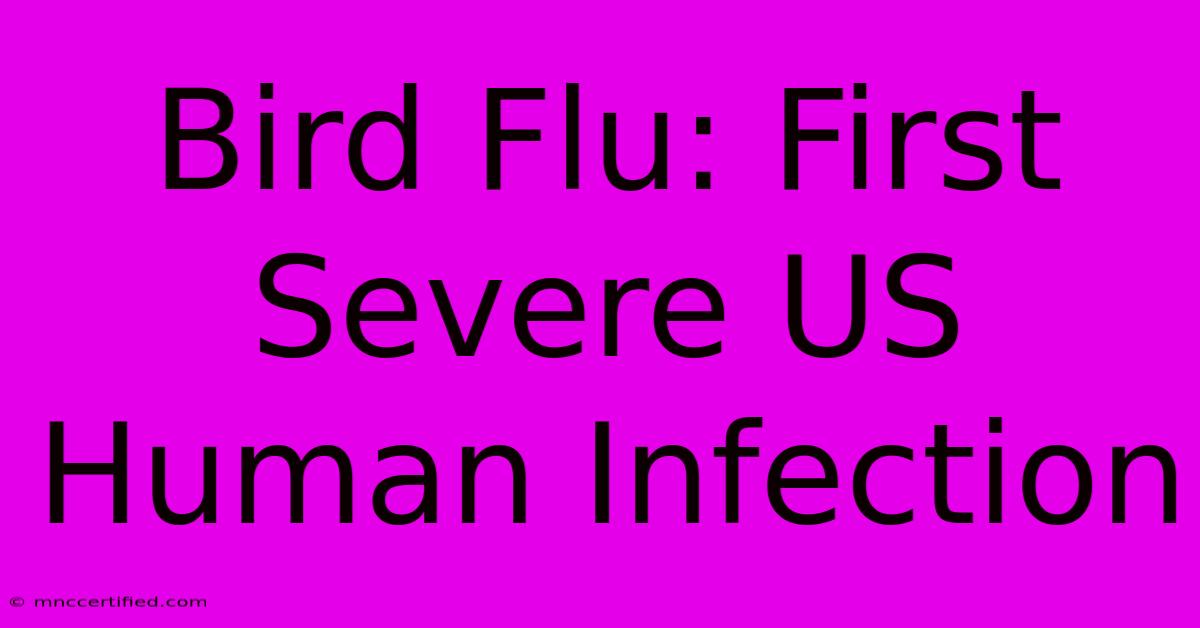 Bird Flu: First Severe US Human Infection