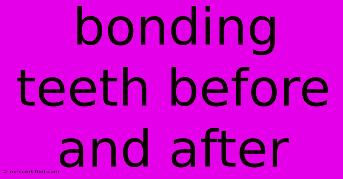 Bonding Teeth Before And After