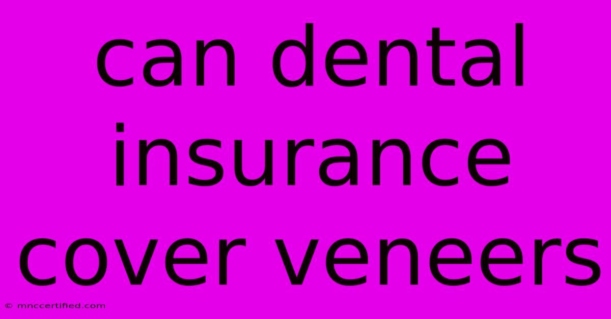 Can Dental Insurance Cover Veneers