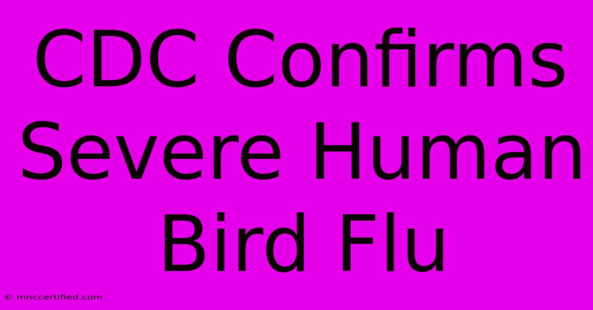 CDC Confirms Severe Human Bird Flu