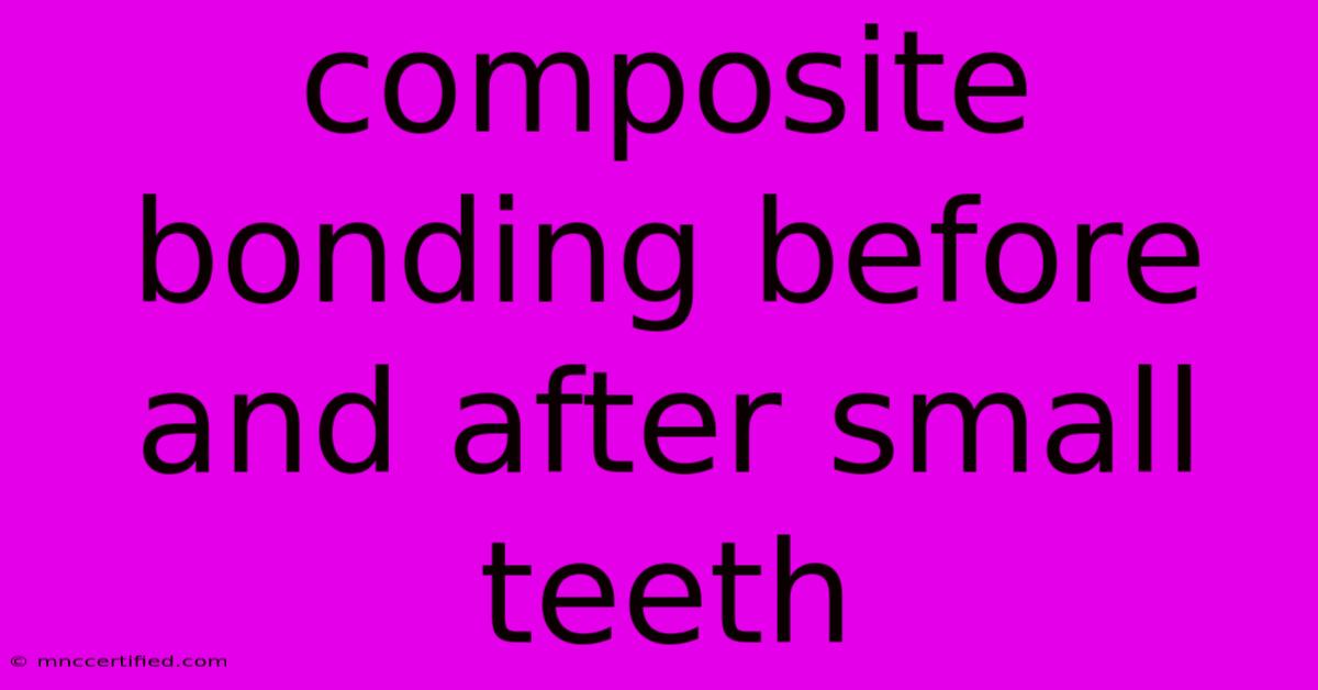 Composite Bonding Before And After Small Teeth