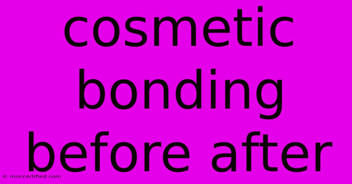 Cosmetic Bonding Before After