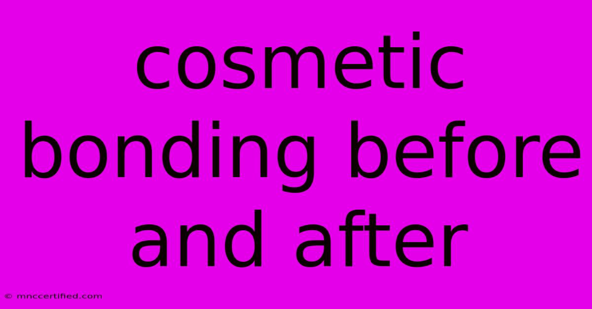 Cosmetic Bonding Before And After