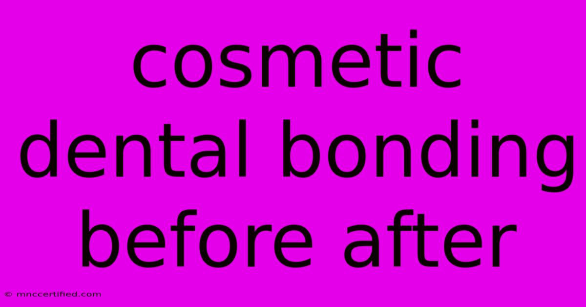 Cosmetic Dental Bonding Before After