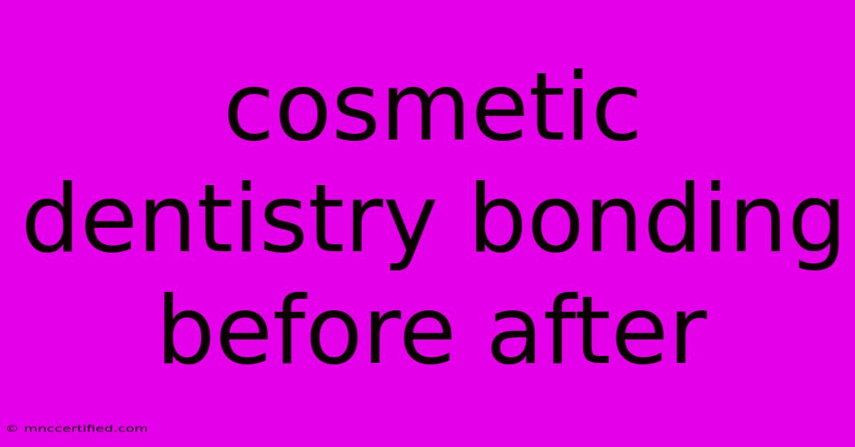 Cosmetic Dentistry Bonding Before After