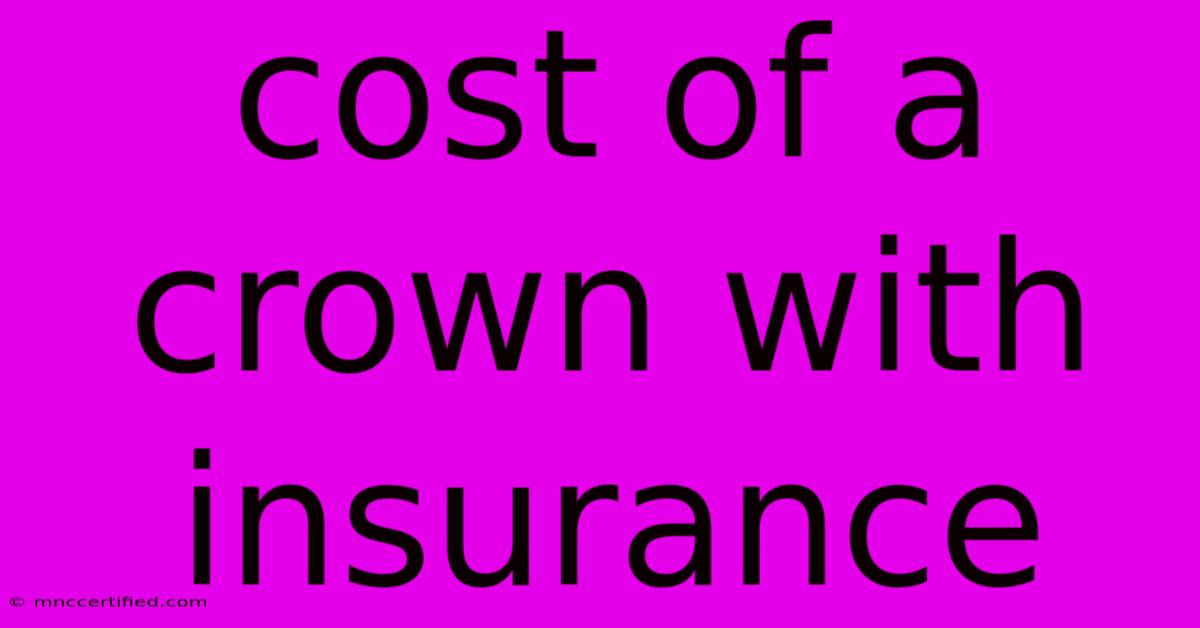 Cost Of A Crown With Insurance