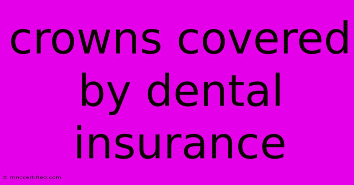 Crowns Covered By Dental Insurance