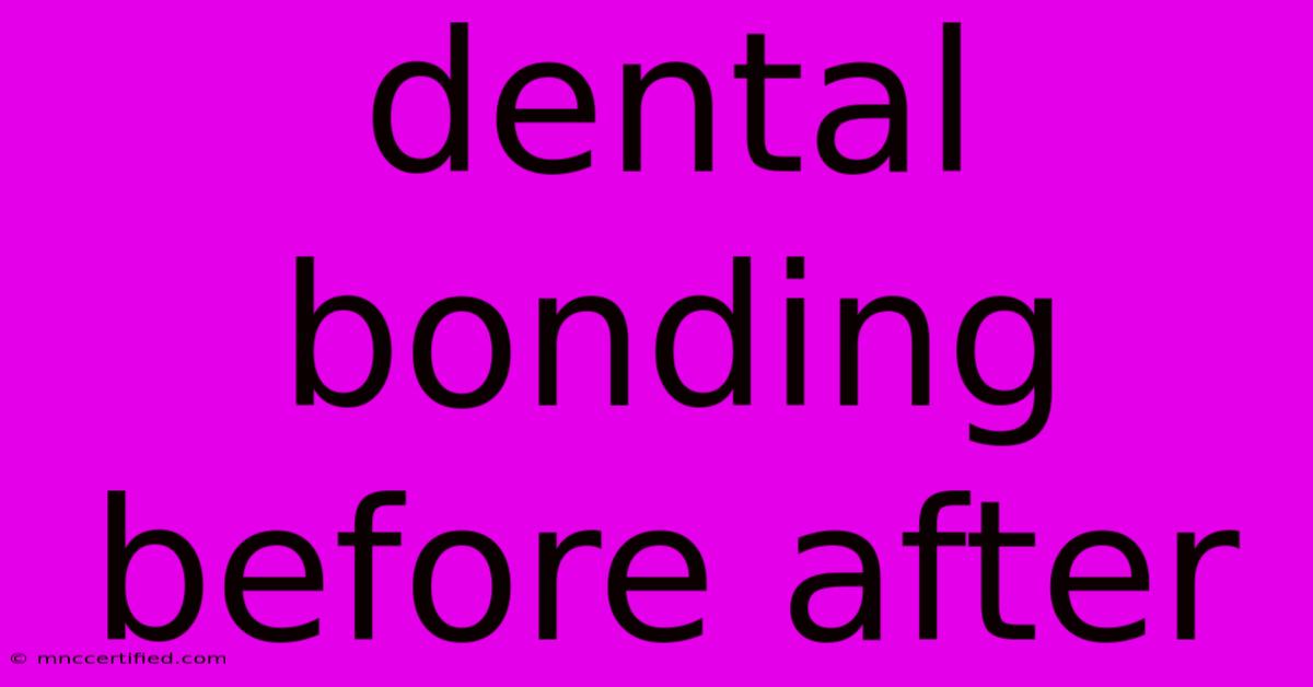 Dental Bonding Before After