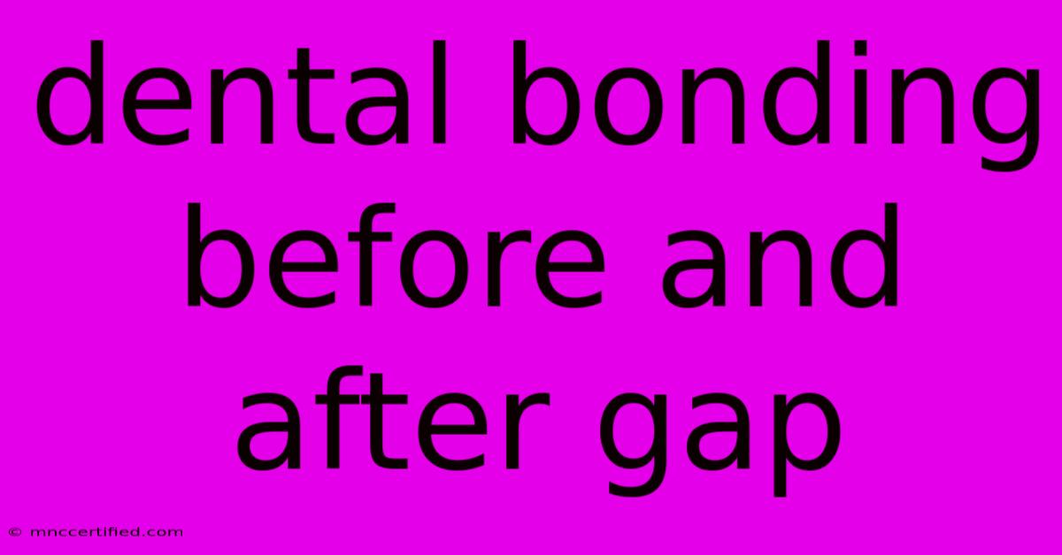 Dental Bonding Before And After Gap