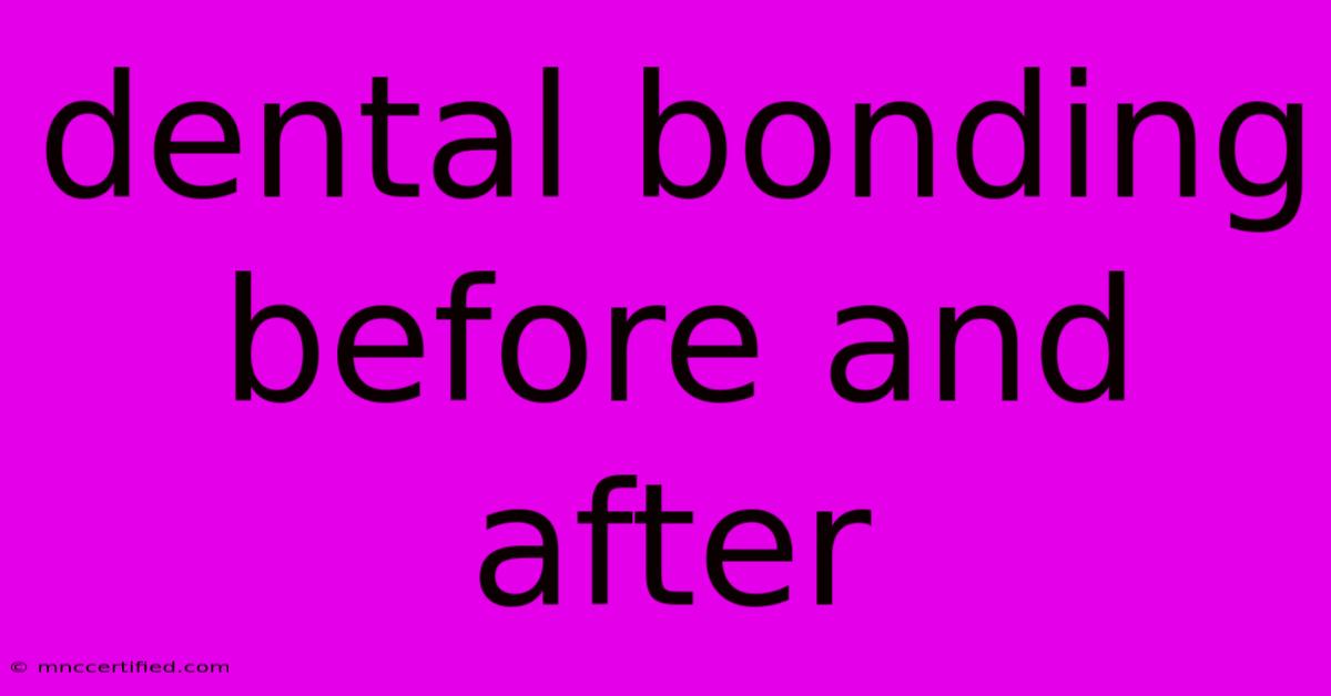 Dental Bonding Before And After