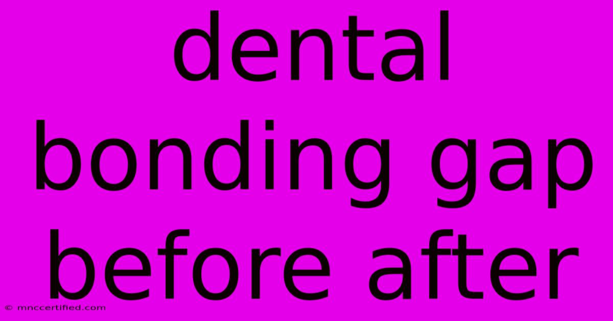 Dental Bonding Gap Before After