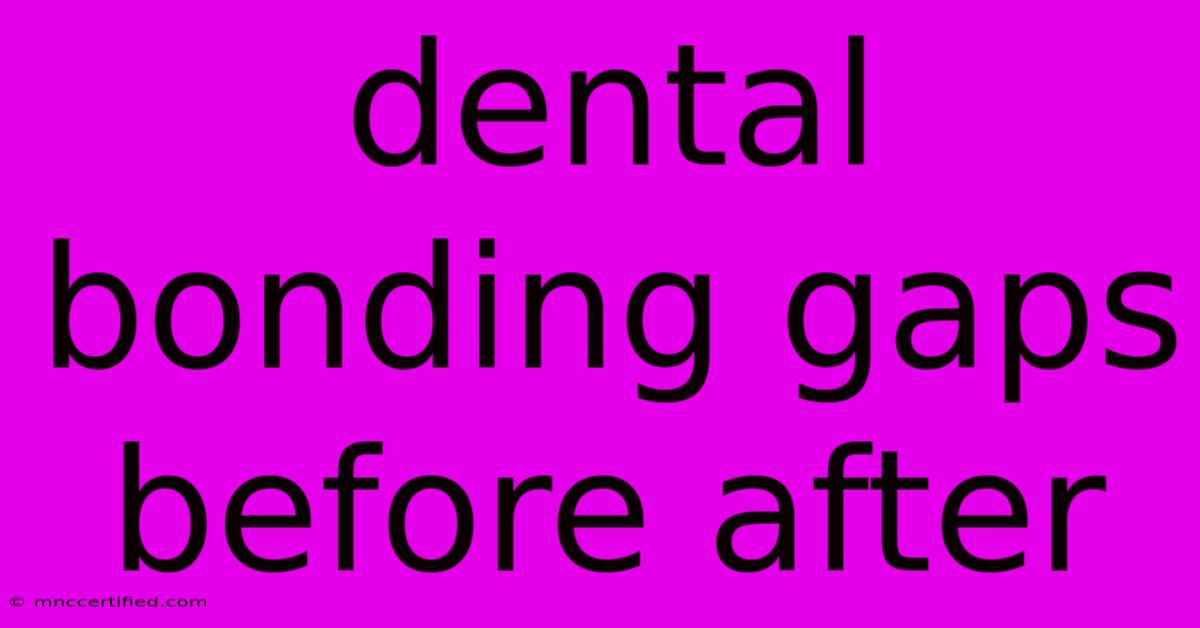 Dental Bonding Gaps Before After