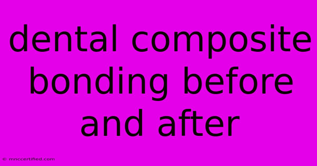 Dental Composite Bonding Before And After