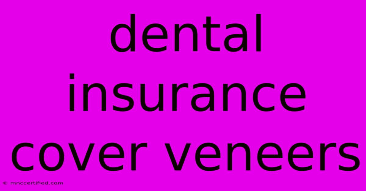 Dental Insurance Cover Veneers