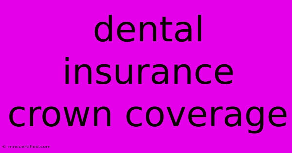 Dental Insurance Crown Coverage