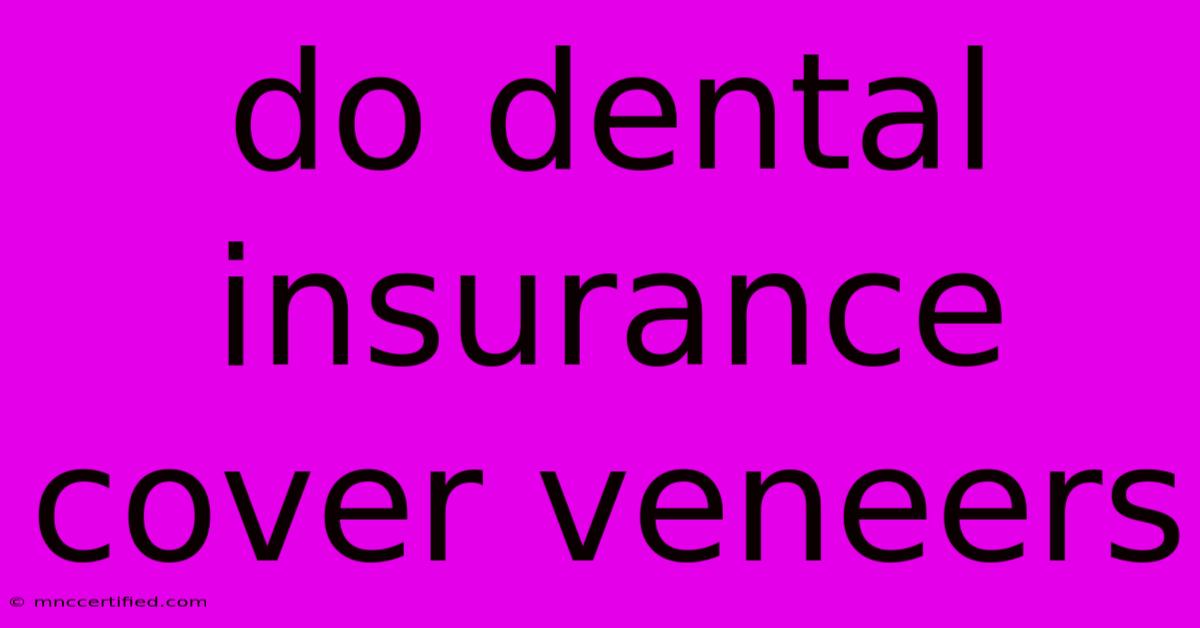 Do Dental Insurance Cover Veneers