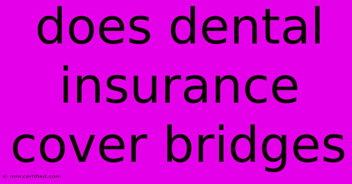 Does Dental Insurance Cover Bridges