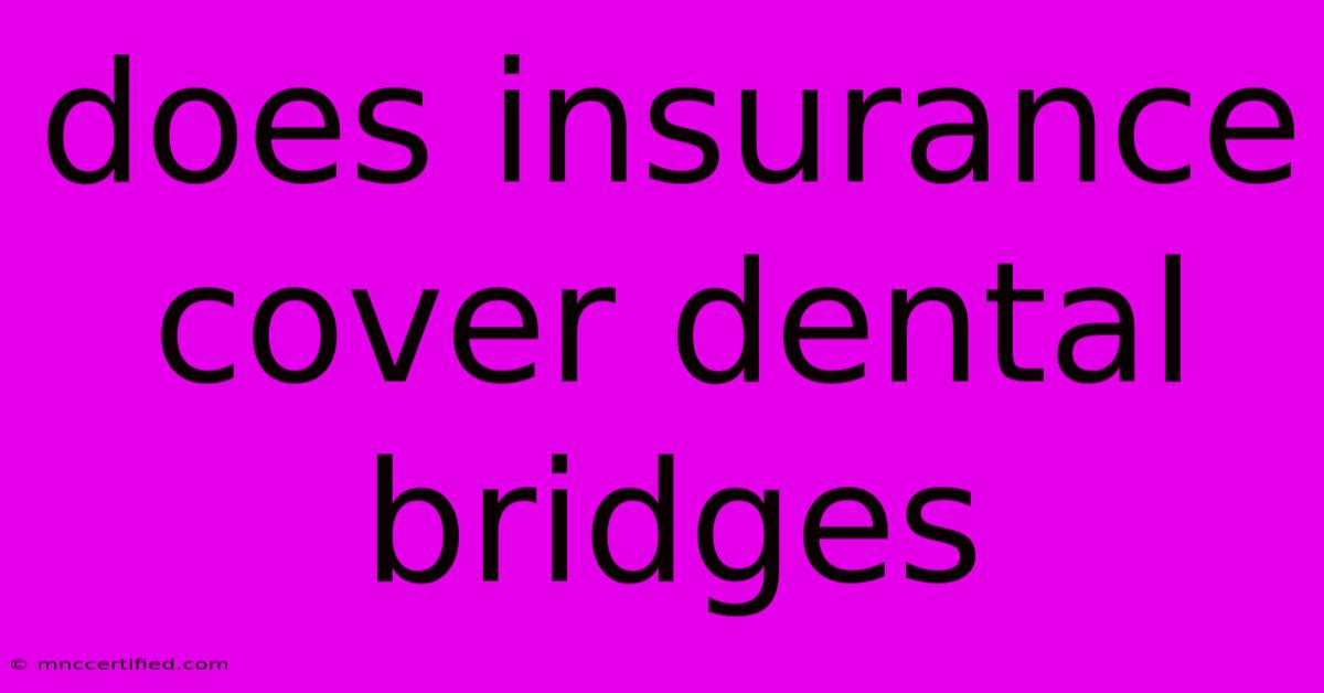 Does Insurance Cover Dental Bridges