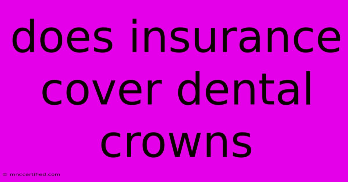 Does Insurance Cover Dental Crowns