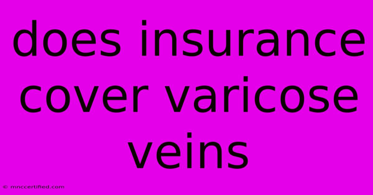 Does Insurance Cover Varicose Veins