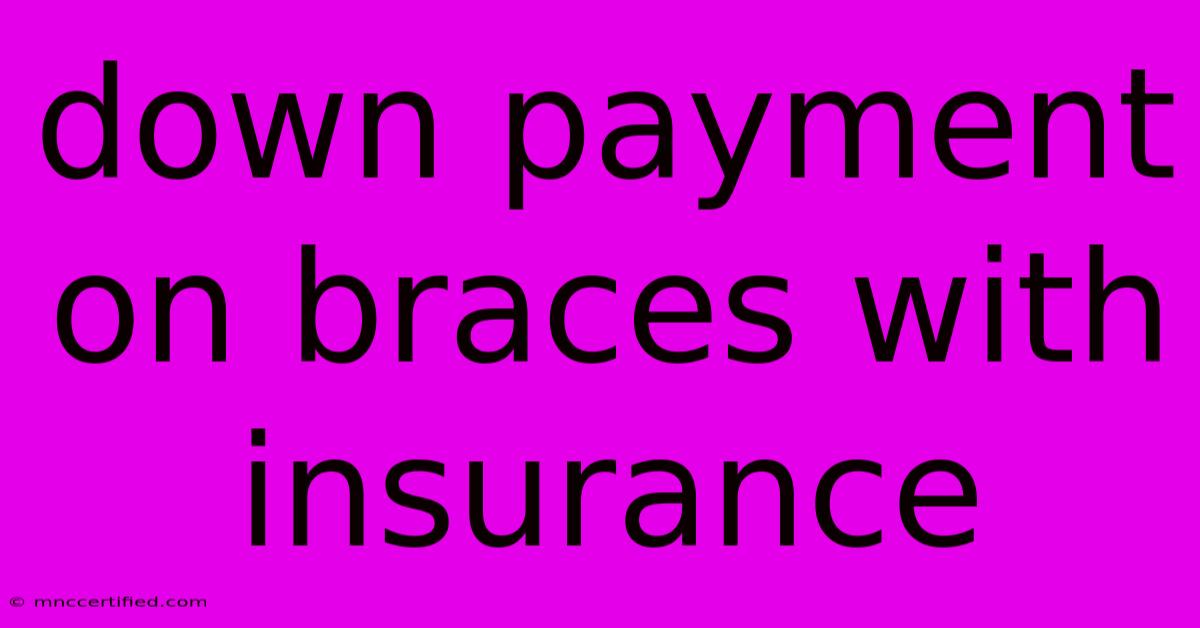 Down Payment On Braces With Insurance