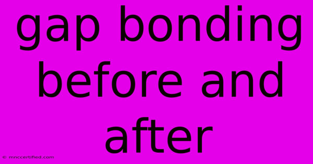 Gap Bonding Before And After