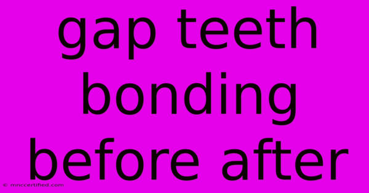 Gap Teeth Bonding Before After