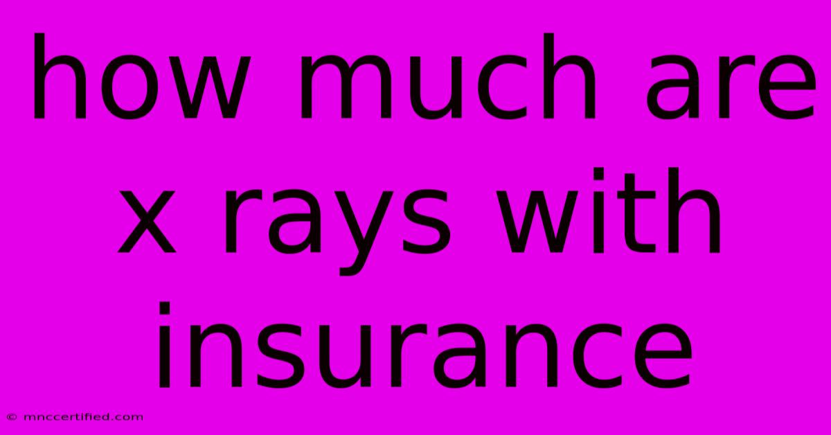 How Much Are X Rays With Insurance