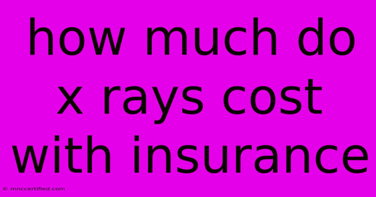 How Much Do X Rays Cost With Insurance