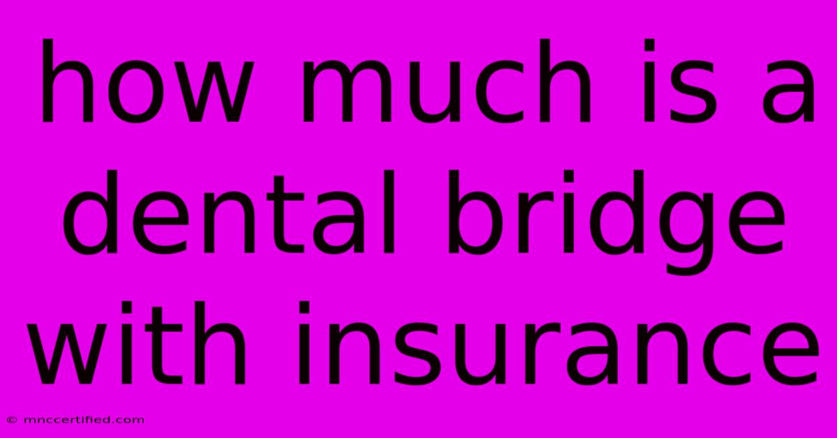 How Much Is A Dental Bridge With Insurance