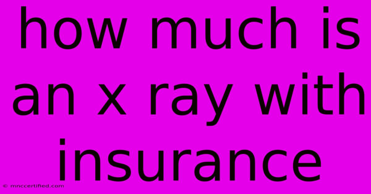 How Much Is An X Ray With Insurance