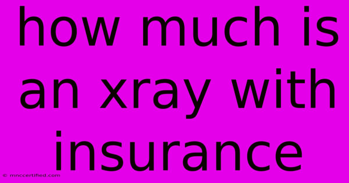 How Much Is An Xray With Insurance