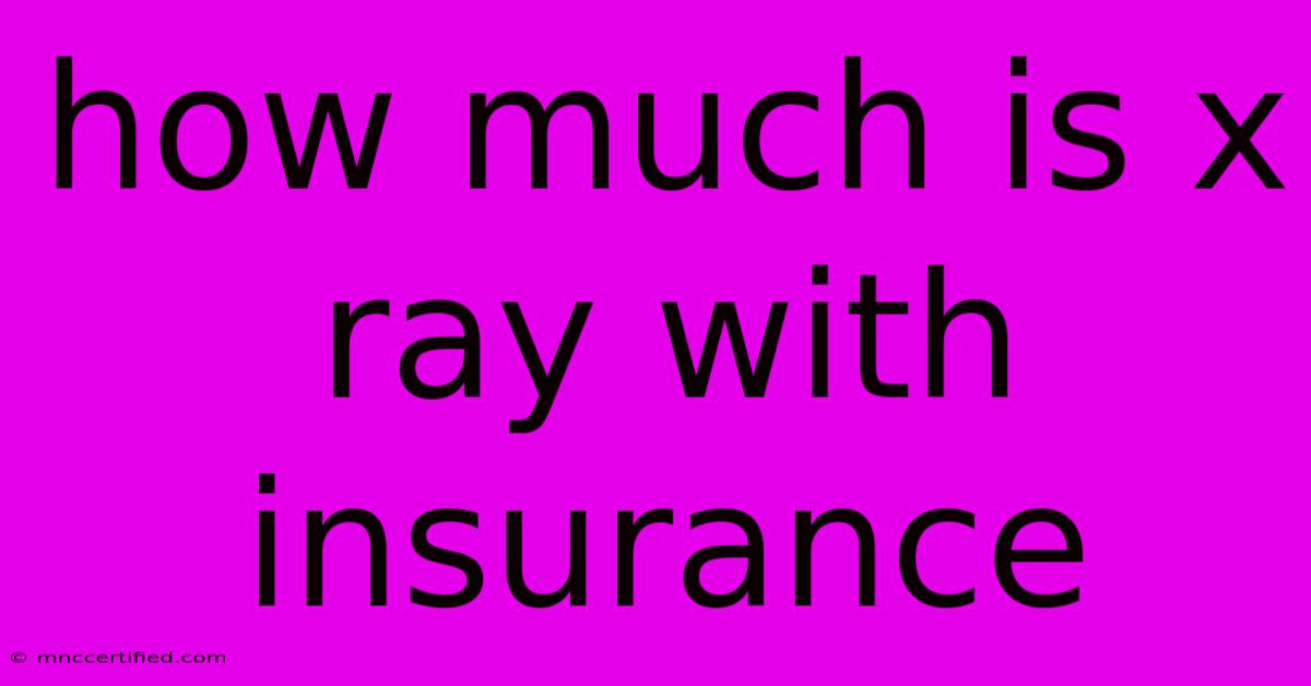 How Much Is X Ray With Insurance