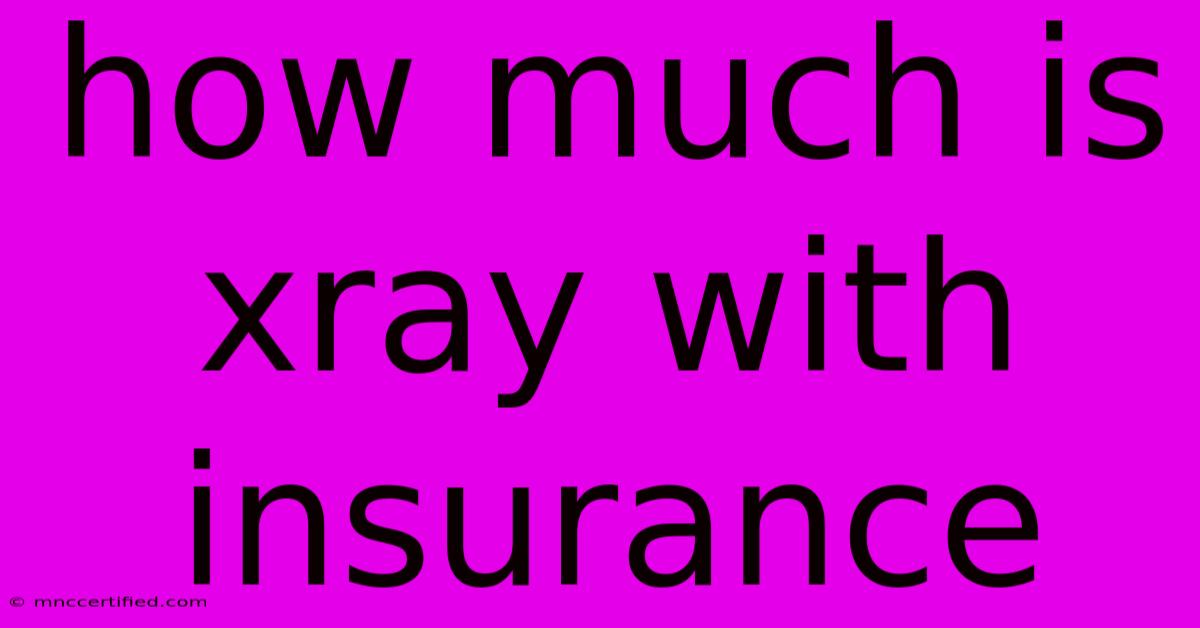 How Much Is Xray With Insurance