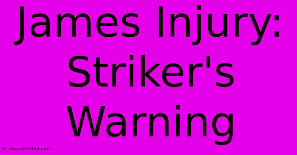 James Injury: Striker's Warning