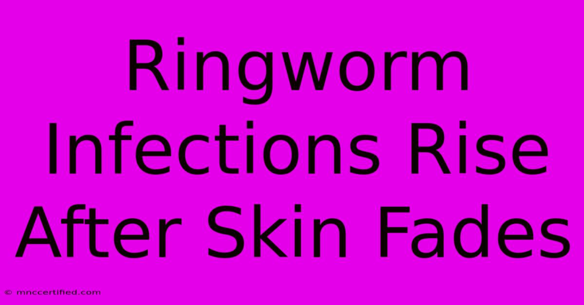 Ringworm Infections Rise After Skin Fades