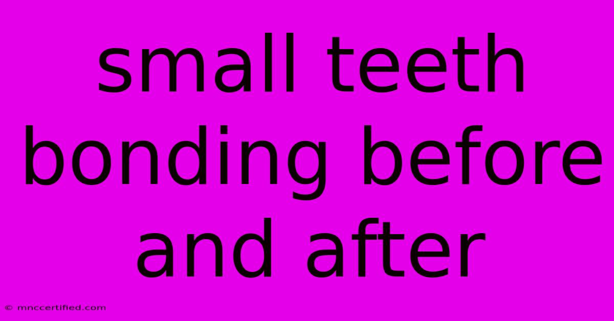 Small Teeth Bonding Before And After