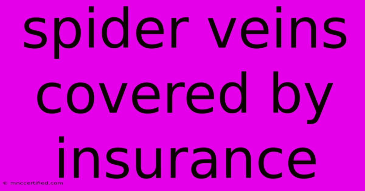 Spider Veins Covered By Insurance