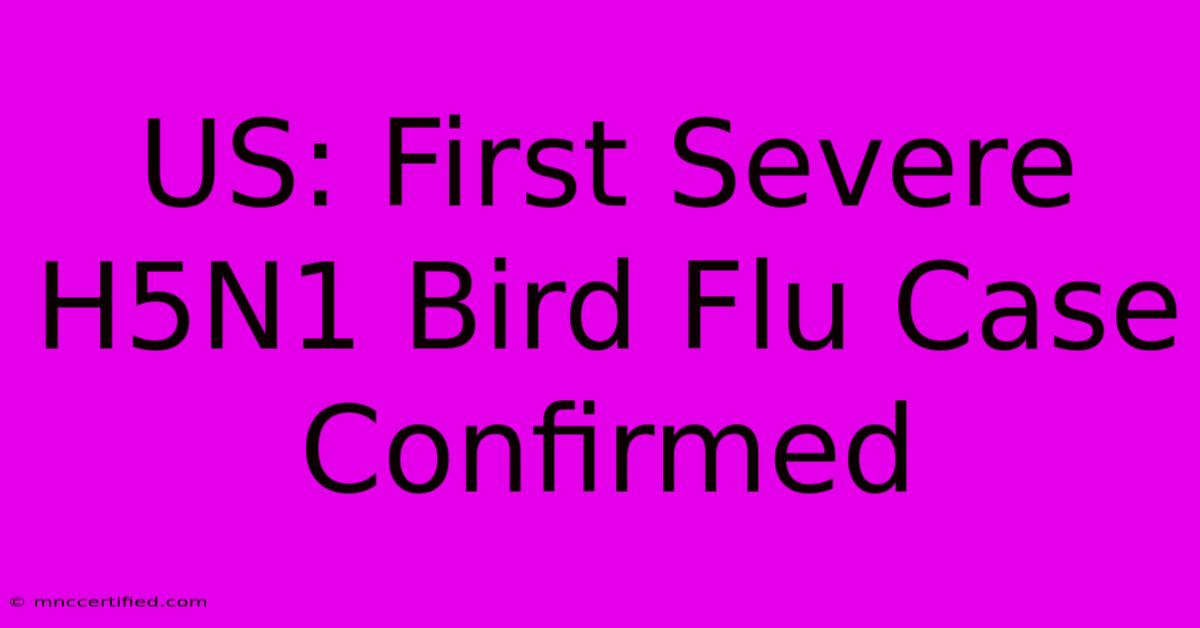 US: First Severe H5N1 Bird Flu Case Confirmed