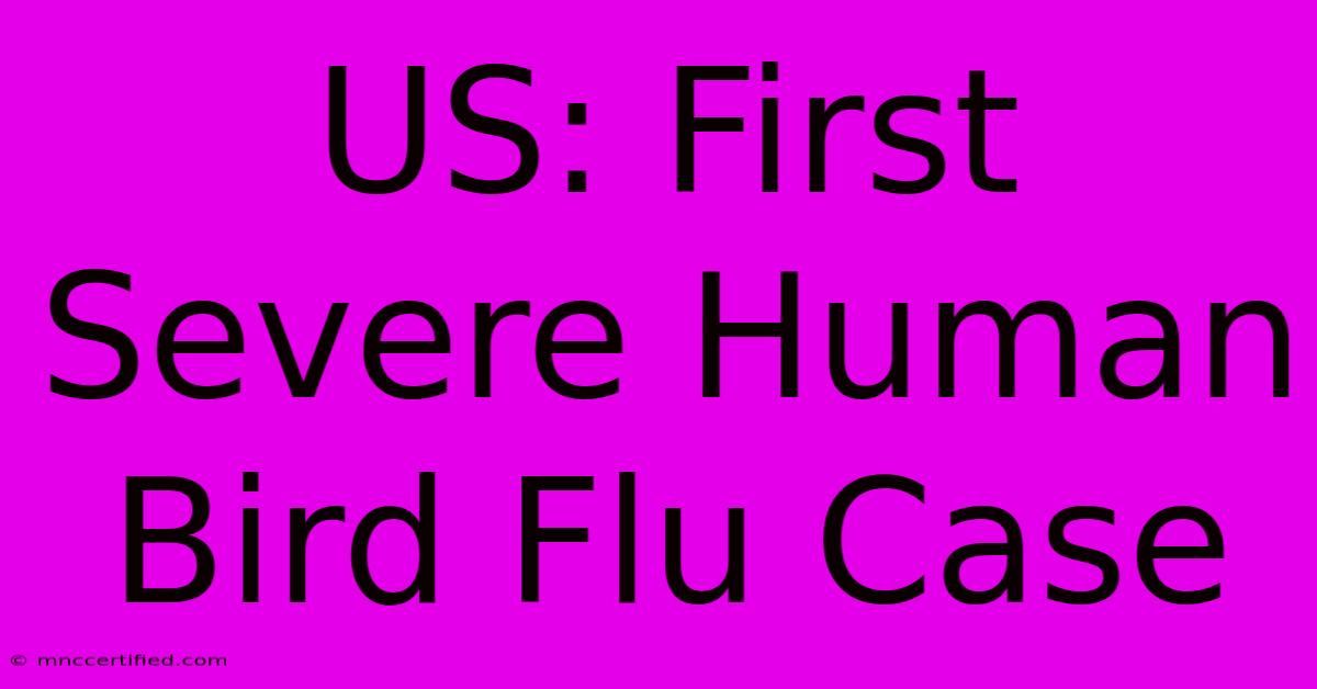 US: First Severe Human Bird Flu Case