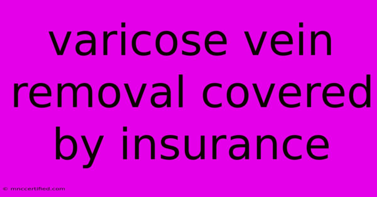 Varicose Vein Removal Covered By Insurance