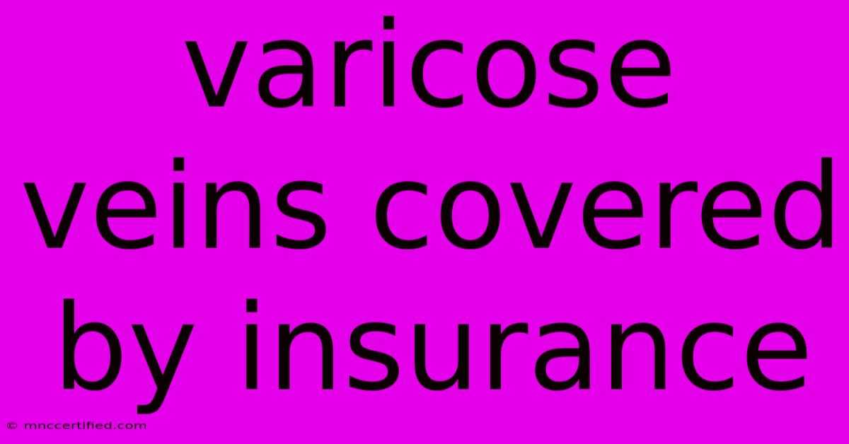 Varicose Veins Covered By Insurance