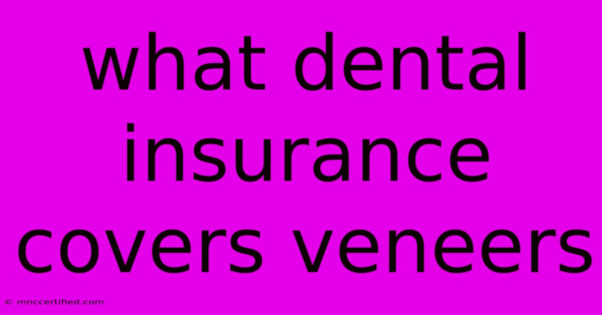 What Dental Insurance Covers Veneers