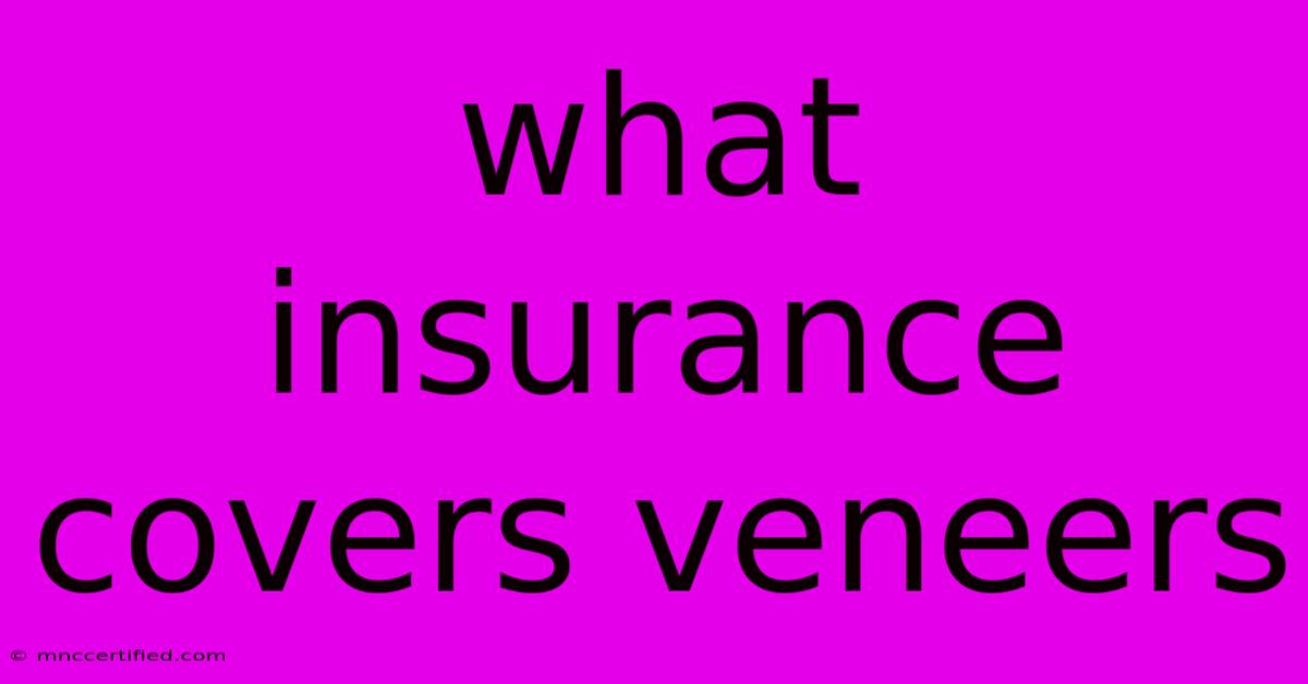 What Insurance Covers Veneers