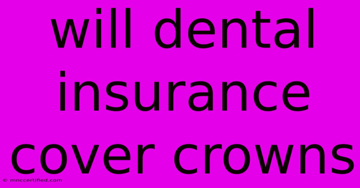 Will Dental Insurance Cover Crowns