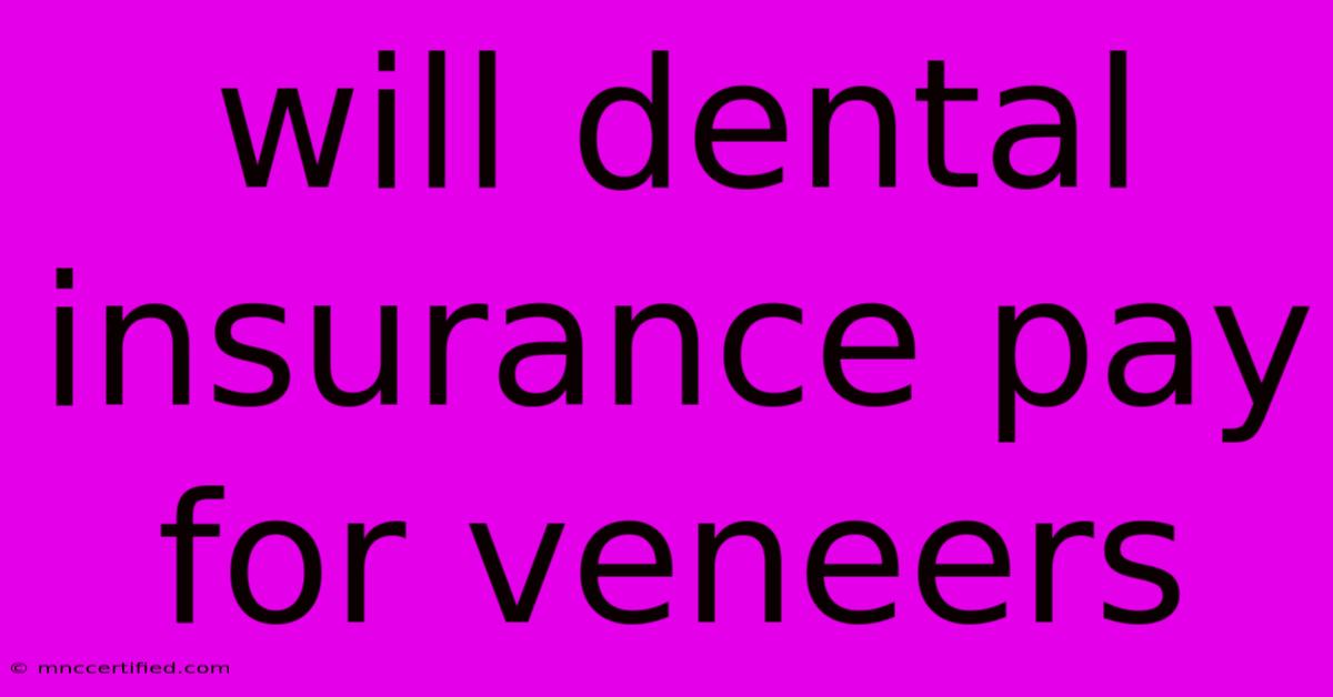 Will Dental Insurance Pay For Veneers